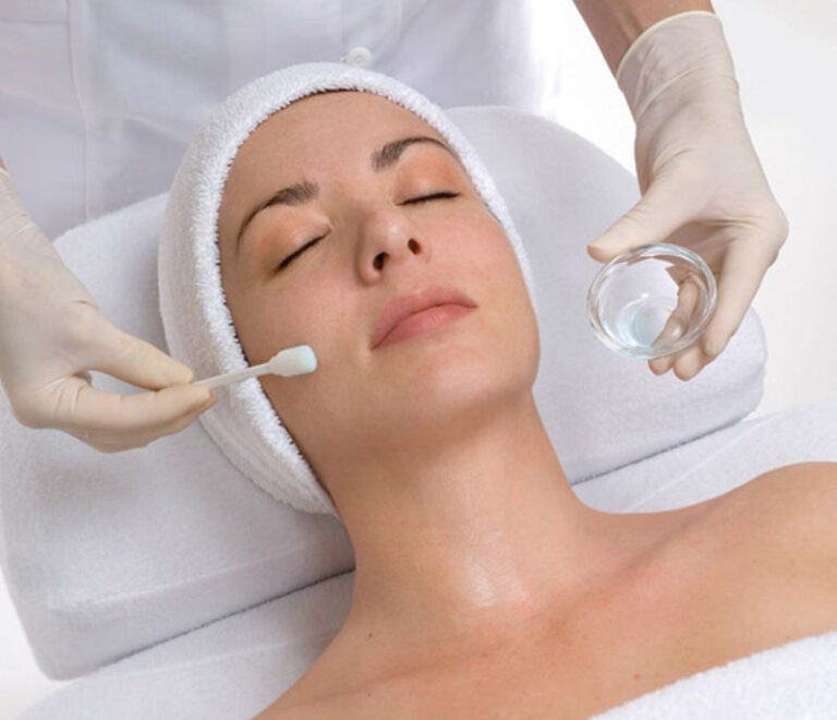 Chemical Peel